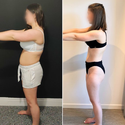 Millie, before and after transformation photo